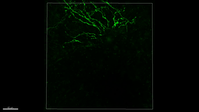 Voltage-gated sodium channel and N-methyl-D-aspartate receptor activation affect calcium influx and neuronal structural plasticity in murine hippocampal neurons
